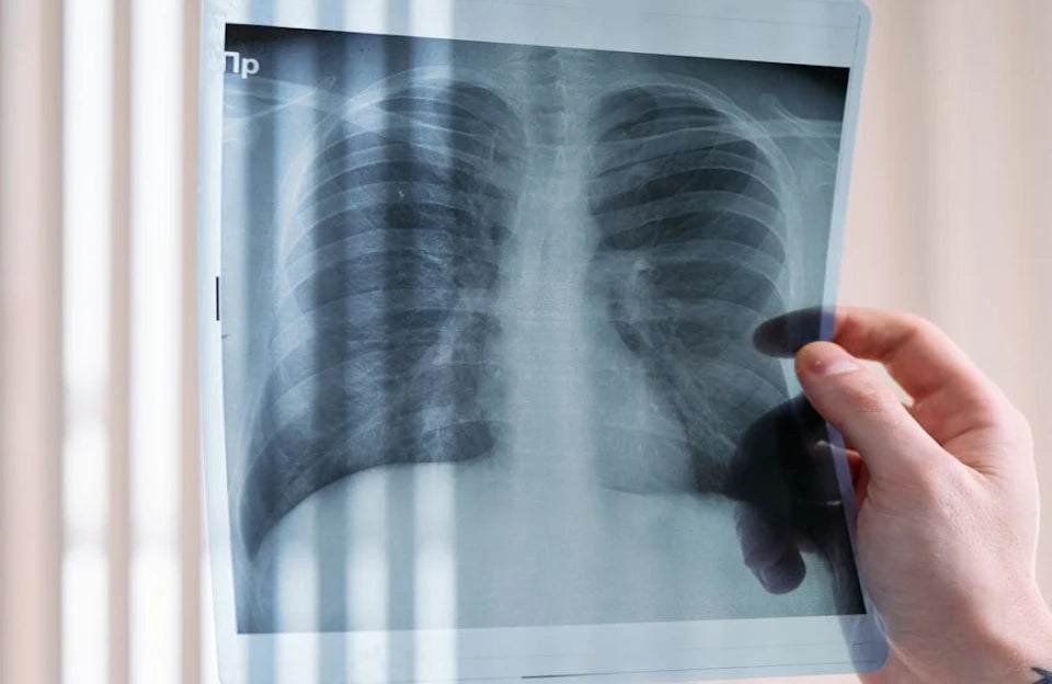 Lung screening category image