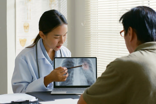 Lung Cancer doctor and patient
