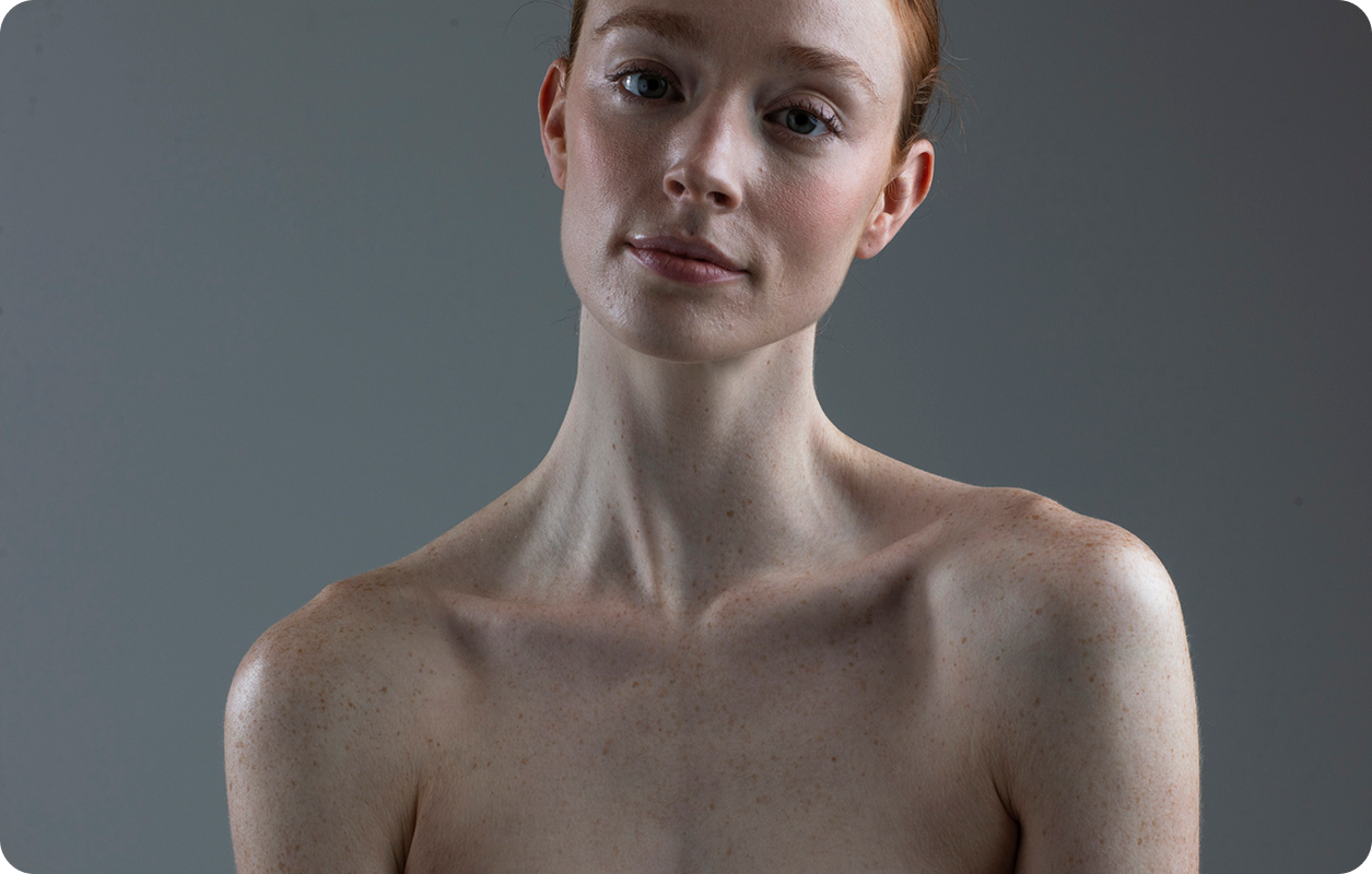 picture of a girl for private skin cancer